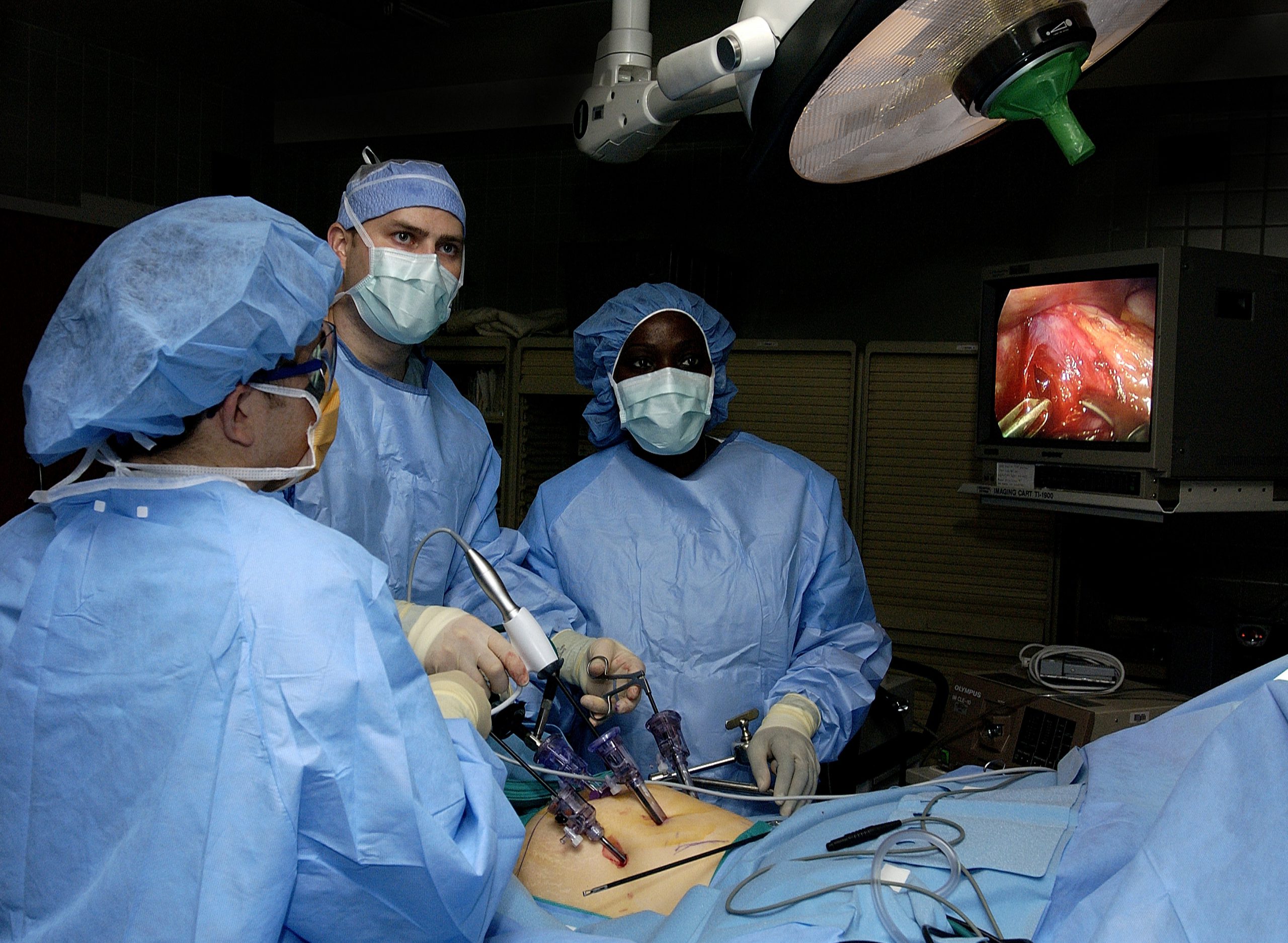 050131-F-1936B-008Doctors Ronald Post (left) and John Smear (center) and Physician's Assistant Debra Blackshire perform laparoscopic stomach surgery at Langley Air Force Base, Va., on Jan. 31, 2005.  The surgery will involve the removal of the gall bladder to help alleviate acid reflux disease.  DoD photo by Staff Sgt. Samuel Bendet, U.S. Air Force.  (Released)